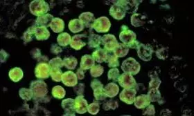 brain-eating amoeba