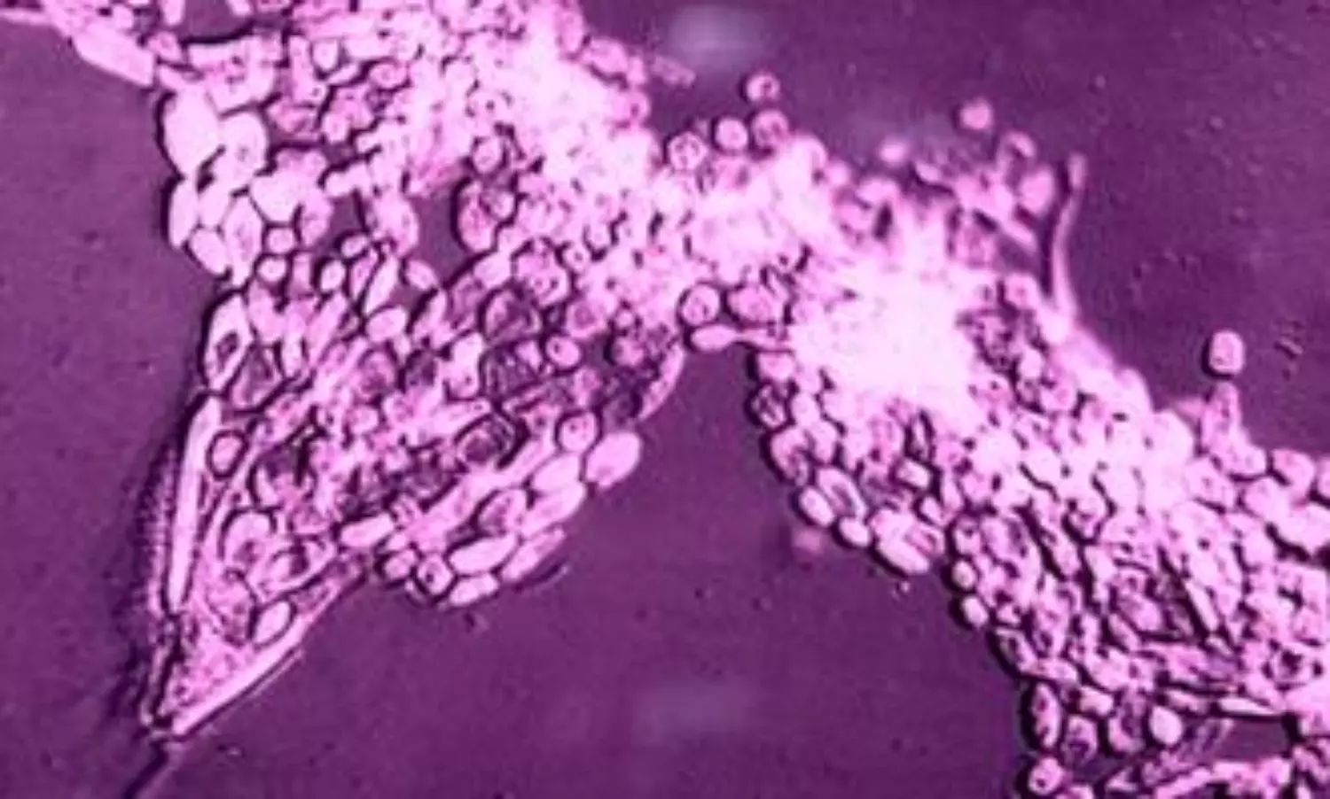 ICMR researchers develop new approach to tackle fungal pathogens