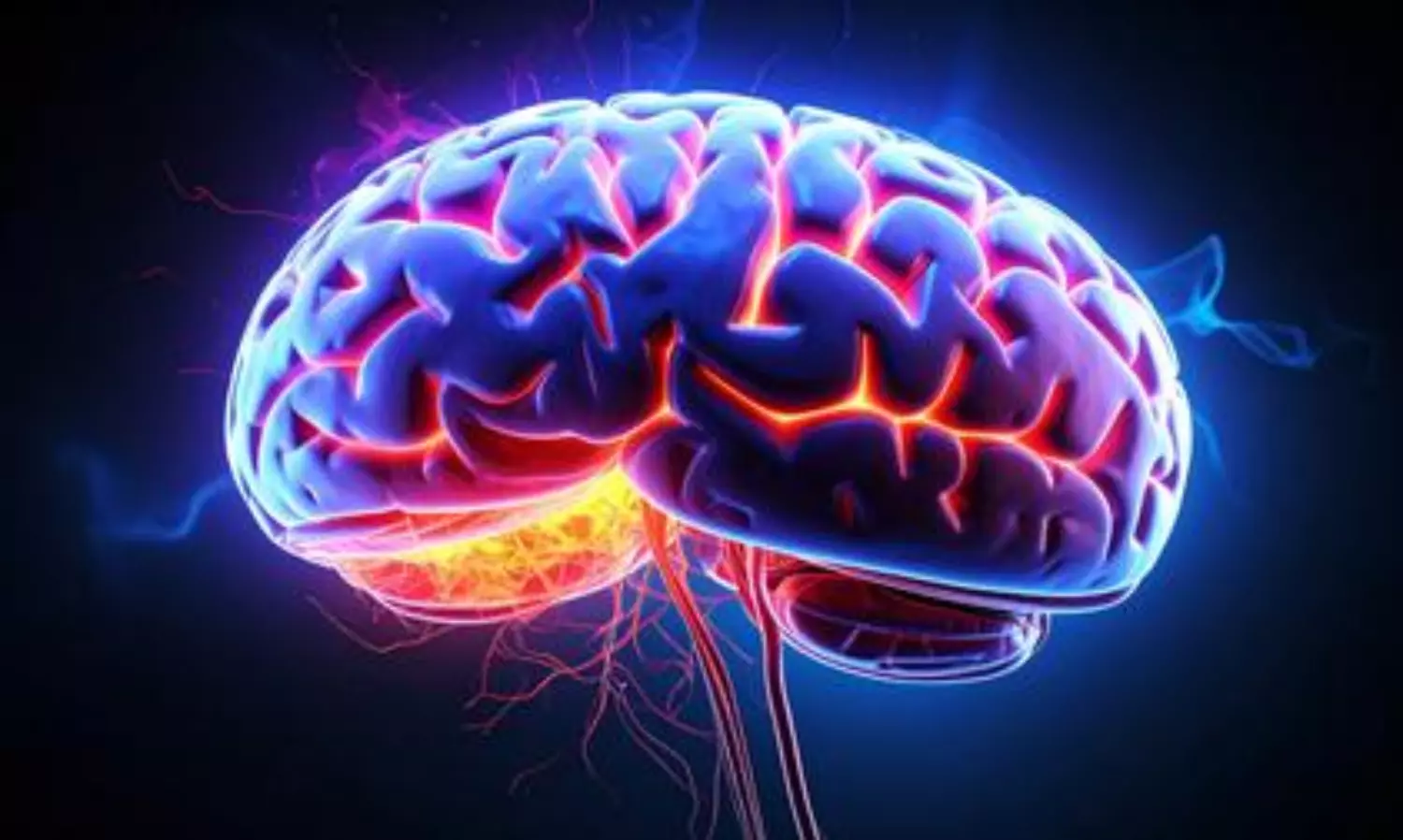 Oral bacteria may raise risk of Parkinson’s disease, study finds