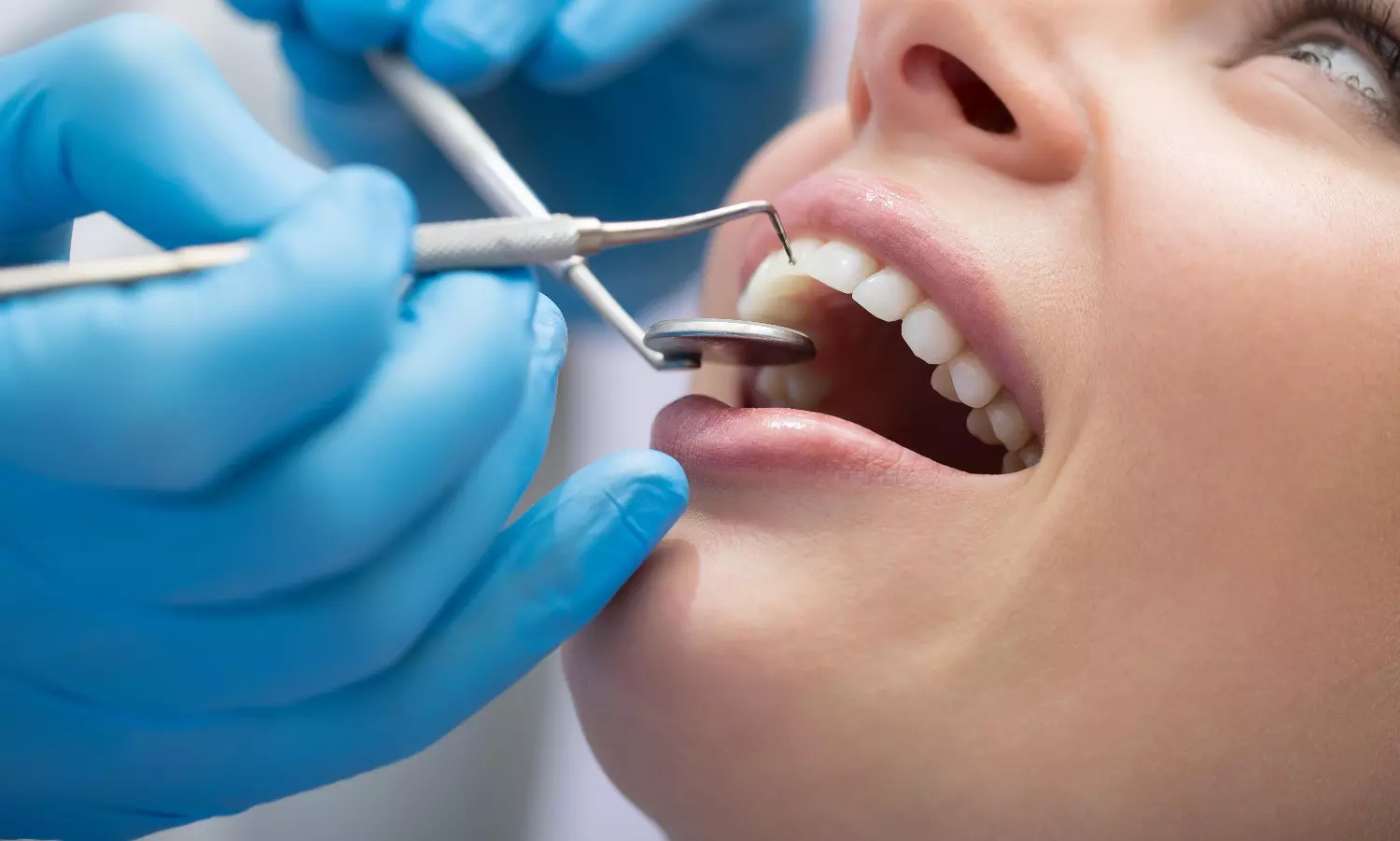 Japanese study uncovers stem cell mechanism to regenerate lost teeth