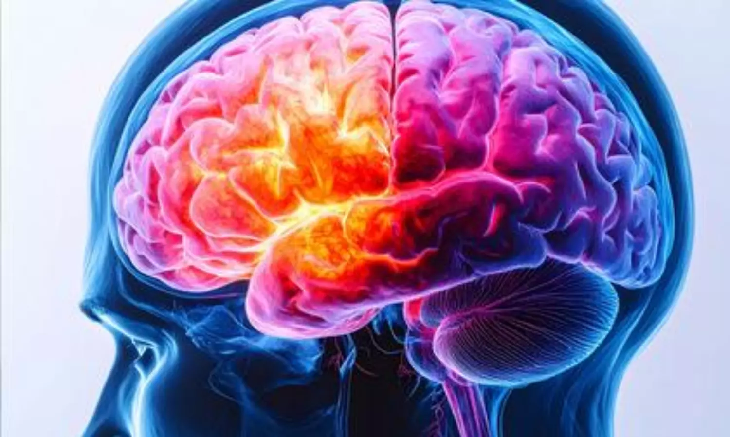 Deadly brain cancer found to erode skull, alter immune response: Study