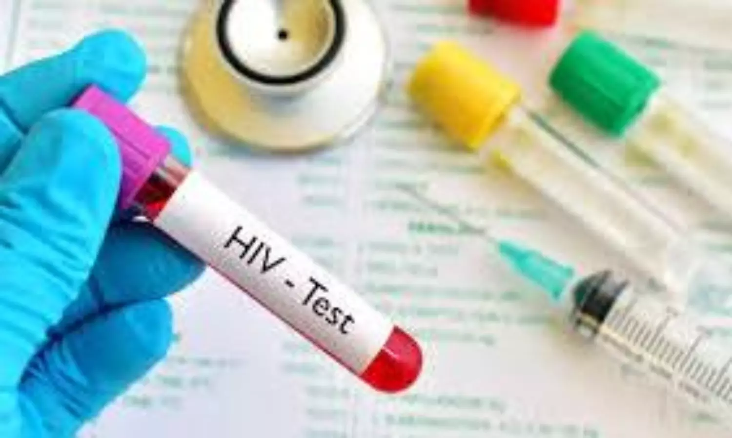 HIV test