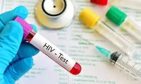 HIV test
