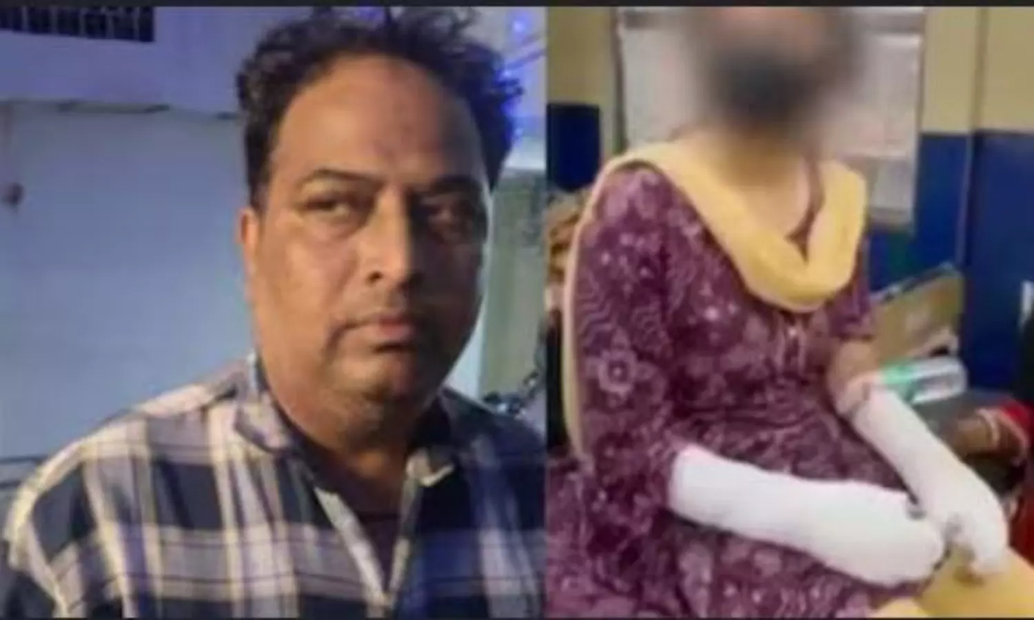 Delhi acid attack case: woman fabricates story at the instance of her father