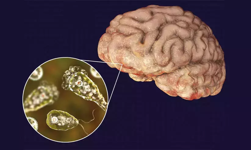 Brain eating amoeba: Experts call for coordinated scientific plan