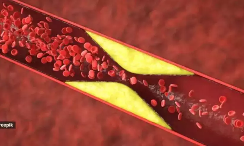 Australia runs historic gene editing therapy to halve bad cholesterol