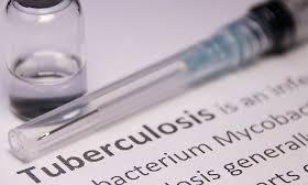 WHO applauds India’s ‘encouraging gains’ in fight against tuberculosis