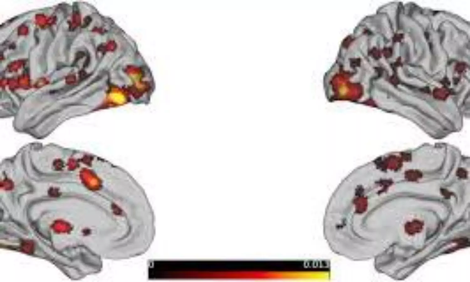 brain activity patterns