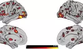 brain activity patterns