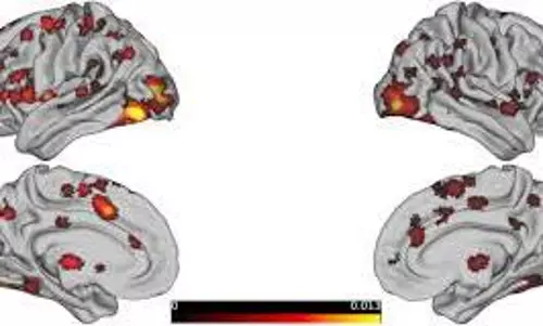 brain activity patterns