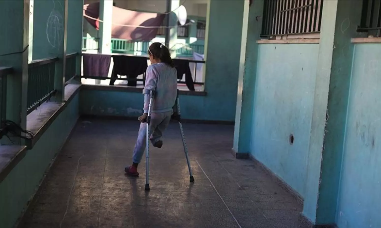 Lack of prosthetic limb supplies: Amputees struggle in Gaza
