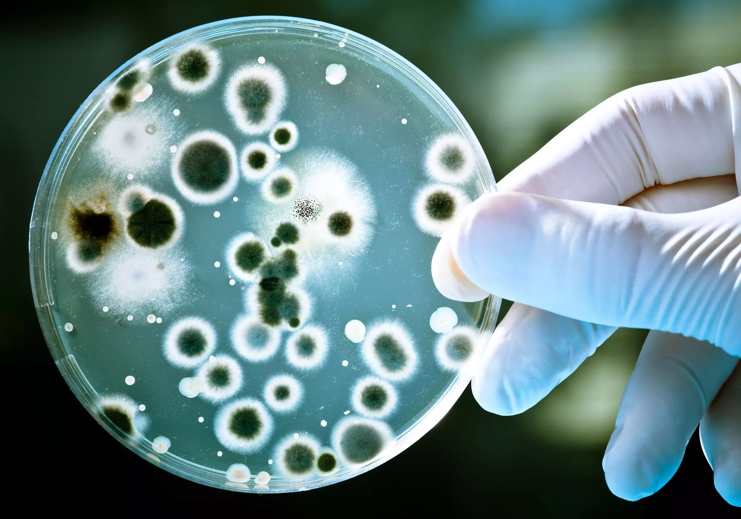 Study warns of high levels of antibiotic-resistant superbugs in Delhi air Study warns of high levels of antibiotic-resistant superbugs in Delhi air