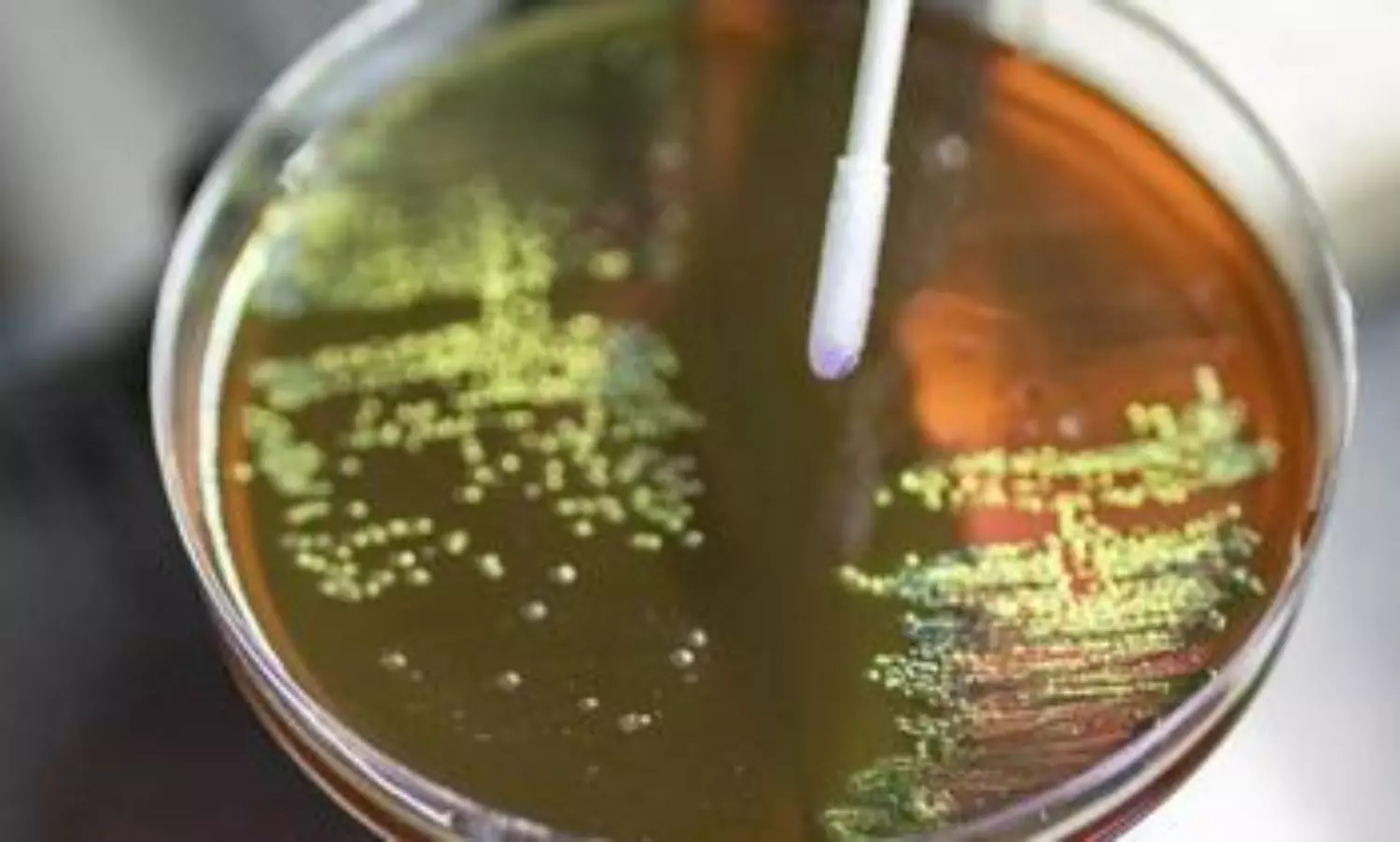 Study finds antibiotic use during pregnancy raise risk of bacterial disease in babies