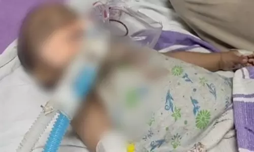 Rajasthan: 8-month-old girl dies after being fed acid by mother