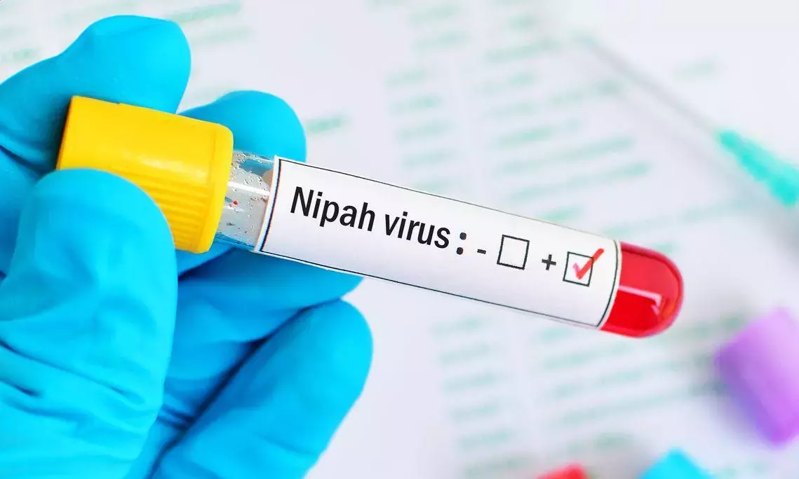 Nipah alert in Kerala as Kozhikode man tests positive in preliminary screening Nipah alert in Kerala as Kozhikode man tests positive in preliminary screening