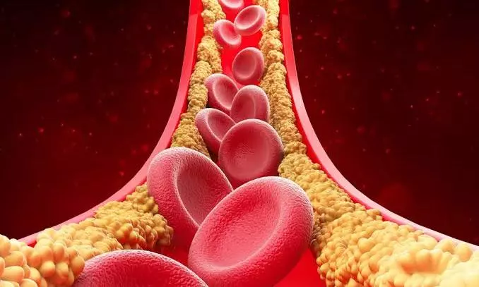 cholesterol cholesterol