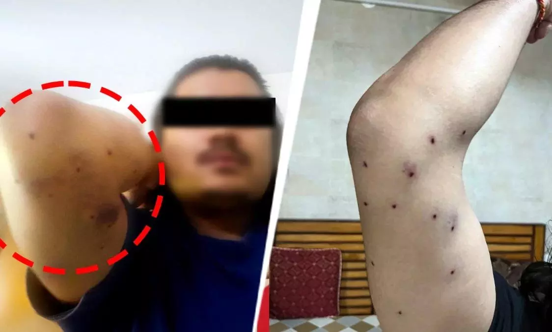 Probe after RAF allegedly used pellet rounds during Parliament march Probe after RAF allegedly used pellet rounds during Parliament march