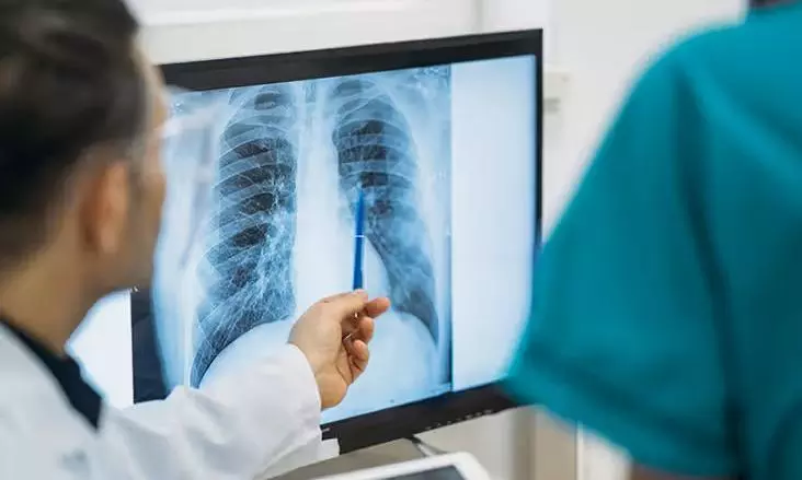 Drug-resistant tuberculosis: Early detection, effective treatment Drug-resistant tuberculosis: Early detection, effective treatment