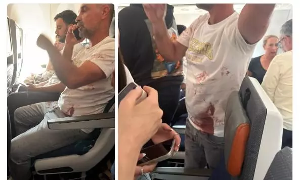 Pilot stabbed in cockpit brawl, emergency code triggers hijacking scare, Israel rules out hijacking Pilot stabbed in cockpit brawl, emergency code triggers hijacking scare, Israel rules out hijacking