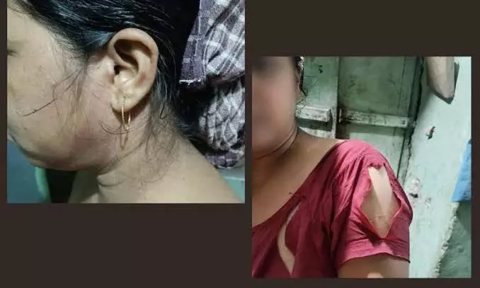 West Bengal woman alleges assault, forced religious conversion by Bajrang Dal-linked group West Bengal woman alleges assault, forced religious conversion by Bajrang Dal-linked group